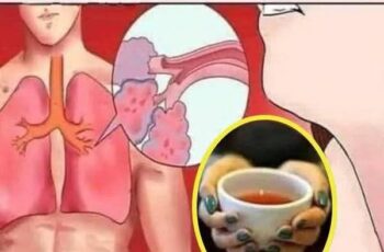 Just 3 tablespoons a day, this recipe loosens phlegm from the lungs, improves cough, flu, and treats sinusitis