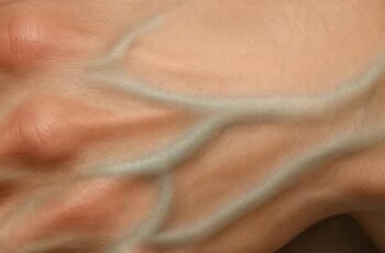 Why Do Some People Have Visible Veins While Others Don’t?