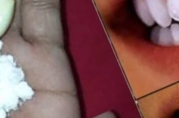 Garlic: A Surprising Friend for Making Teeth Whiter