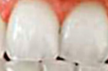 How to Naturally Whiten Your Teeth at Home in Just 3 Minutes