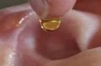 Put 2 drops in your ear and you will hear like before. Recover your hearing.