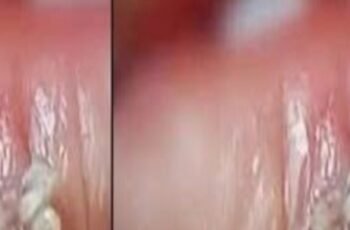 BE VERY CAREFUL . If you get this, you are infected with BE VERY CAREFUL . If you get this, you are infected with