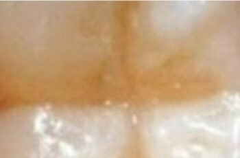 Natural Ways to Maintain Good Dental Health