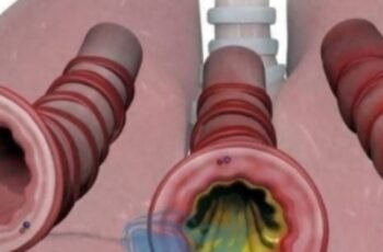 What Is Phlegm and Why Does It Accumulate?