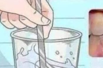 Remove tartar from your teeth and whiten them with thi