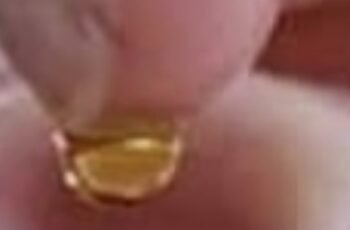Put 2 drops in your ear and you will hear like before. Recover your hearing