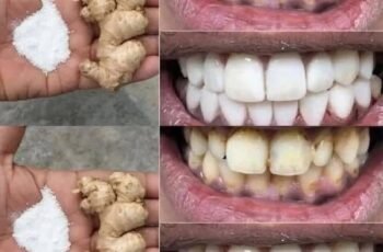 Discover the Natural Wonder of Turmeric for Dental Health