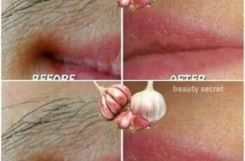 Say goodbye to undesired hair using garlic
