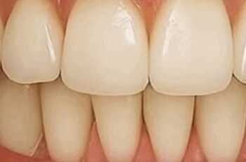 Grandma’s Secret To A Brighter Smile: Guava Leaves For Natural Oral Care Grandma’s Secret To A Brighter Smile: Guava Leaves For Natural Oral Care
