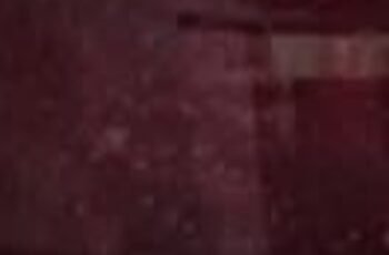 Heavy legs, fatigue and tingling… your circulation