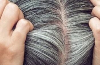 Get Rid of Gray Hair Naturally with Just 2 Ingredients: Potato Peels and Water