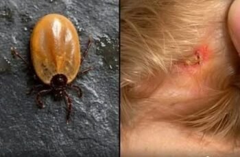 What Parents Should Know About Ticks: Small Creatures, Big Concerns